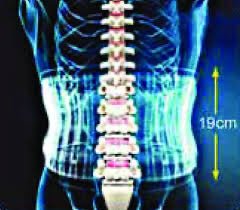 DR HO S 2 in 1 Back Belt