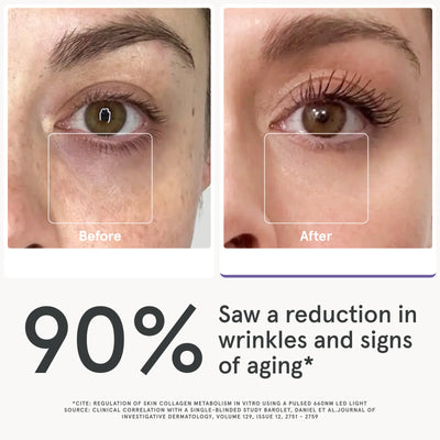 **iRESTORE Illumina LED Eye Mask