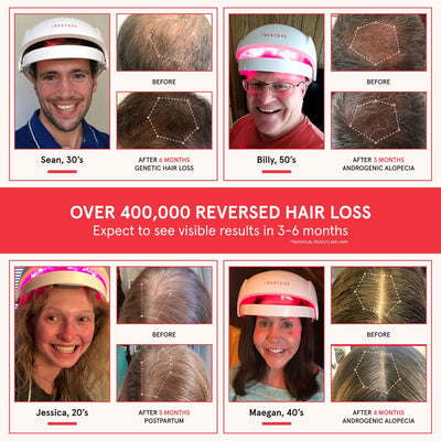 Mega Sale-iRESTORE - Hair Growth System Essential- Top Canadian Hair Growth Helmet- Recommend By Doctors