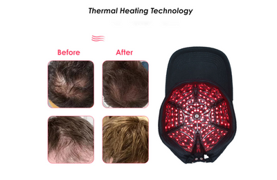 PREORDER - Biomol - Red Light Therapy Cap for Hair Growth with Smart Controller