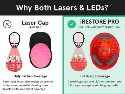 iRESTORE- Premium Hair Growth Professional - 282 Medical Grade Lasers-FDA Approved - Relaxacare